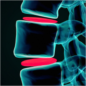 Spinal Clinics / Chiropractor & physiotherapists - London | London Spine & Joint Clinic: UK